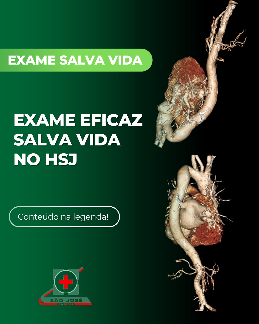 Exame eficaz salva vida no Hospital São José