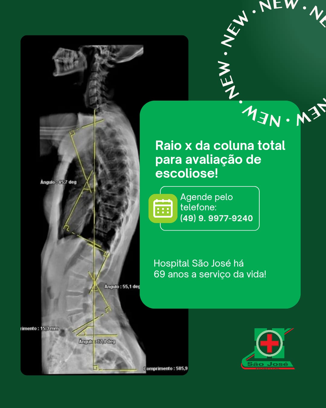 HSJ conta com atendimento de Raio-X completo de coluna para tratamento de escoliose